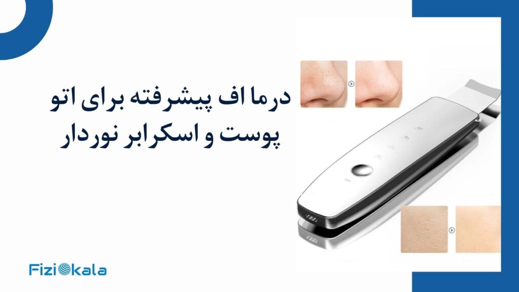 اسکرابر یون‌دار M22