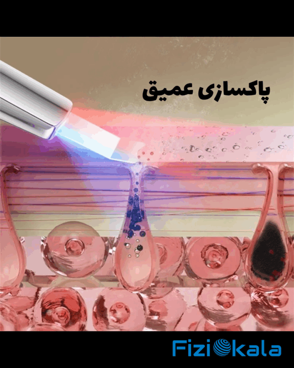 اسکرابر یون‌دار M22