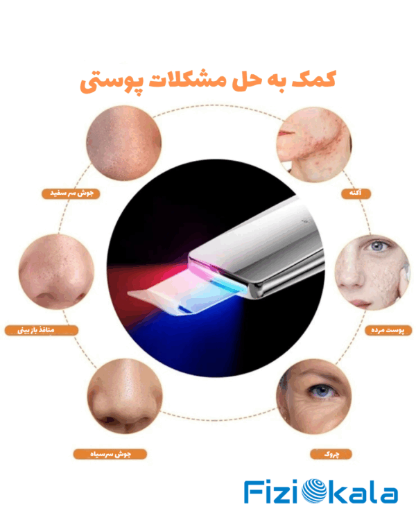 اسکرابر یون‌دار M22